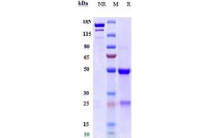 Anti-TYRO3 Reference Antibody (ELB031) on SDS-PAGE under reducing (R) condition.