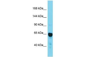 Western Blotting (WB) image for anti-Transforming, Acidic Coiled-Coil Containing Protein 2 (TACC2) (C-Term) antibody (ABIN2788943) (TACC2 antibody  (C-Term))
