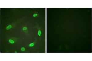 Immunofluorescence analysis of HeLa cells, using p53 (Acetyl-Lys379) Antibody.