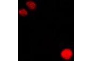 Immunofluorescent analysis of CLIC1 staining in Hela cells. (CLIC1 antibody)