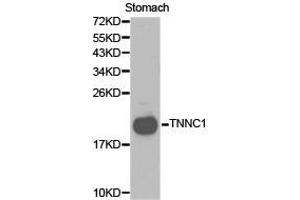 Western Blotting (WB) image for anti-Cardiac Troponin C (TNNC1) antibody (ABIN1875147) (TNNC1 antibody)