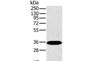 Western Blot analysis of Mouse brain tissue using PPP2CA Polyclonal Antibody at dilution of 1:450 (PPP2CA antibody)