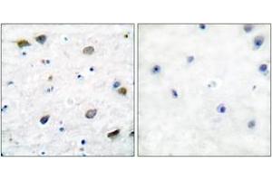 Immunohistochemistry (IHC) image for anti-gamma-aminobutyric Acid (GABA) A Receptor, Subunit beta 1 (GABRB1) (AA 401-450) antibody (ABIN2888567) (GABRB1 antibody  (AA 401-450))