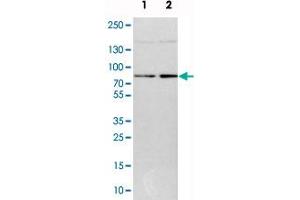 Western blot analysis of cell lysates with DNAJC14 polyclonal antibody  at 1:250-1:500 dilution. (DNAJC14 antibody)