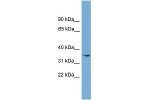 ASB17 antibody used at 1 ug/ml to detect target protein. (ASB17 antibody  (Middle Region))