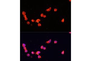 Immunofluorescence analysis of SH-SY5Y cells using CDK5R1 antibody (ABIN7266592) at dilution of 1:100.