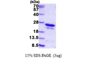 SDS-PAGE (SDS) image for Cold Shock Domain Containing C2, RNA Binding (CSDC2) (AA 1-153) protein (His tag) (ABIN5852940) (CSDC2 Protein (AA 1-153) (His tag))