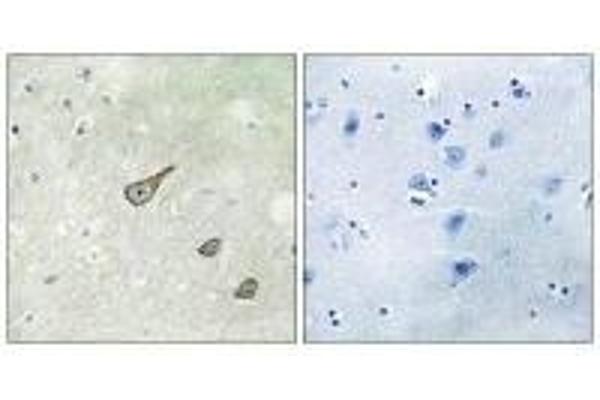 DGKK antibody  (C-Term)