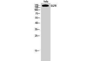 Western Blotting (WB) image for anti-Epidermal Growth Factor Receptor (EGFR) (Ser325) antibody (ABIN3184431) (EGFR antibody  (Ser325))