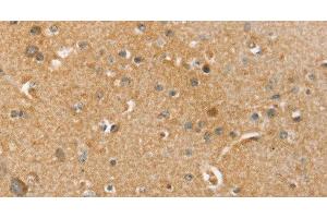 Immunohistochemistry of paraffin-embedded Human brain tissue using SLC41A2 Polyclonal Antibody at dilution 1:45 (SLC41A2 antibody)