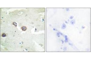 Immunohistochemistry analysis of paraffin-embedded human brain tissue, using CDH4 Antibody. (Cadherin 4 antibody  (AA 731-780))