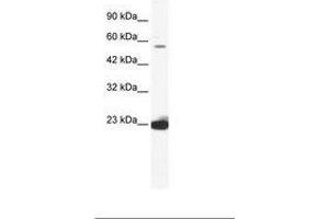 Image no. 1 for anti-DEAD (Asp-Glu-Ala-Asp) Box Polypeptide 55 (DDX55) (AA 468-517) antibody (ABIN202800) (DDX55 antibody  (AA 468-517))
