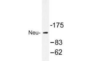 Image no. 1 for anti-Receptor tyrosine-protein kinase erbB-2 (ErbB2/Her2) antibody (ABIN317887) (ErbB2/Her2 antibody)