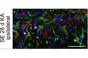 Immunostaining of mouse hippocampal CA1 region showing GFAP and IL1B labeling of astrocytes 28 days after KA-induced status epilepticus (SE). (GFAP antibody  (AA 411-422))