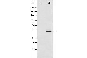 Western blot analysis of CDK2 expression in A2780 whole cell lysates,The lane on the left is treated with the antigen-specific peptide. (CDK2 antibody  (Internal Region))