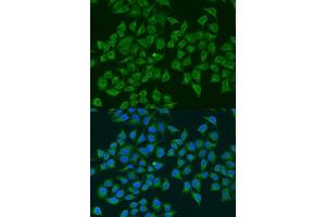 Immunofluorescence analysis of U2OS cells using iNOS antibody (ABIN6129509, ABIN6144728, ABIN6144730 and ABIN6218243) at dilution of 1:100. (NOS2 antibody  (AA 500-730))