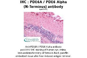 Image no. 1 for anti-phosphodiesterase 6A, CGMP-Specific, Rod, alpha (PDE6A) (N-Term) antibody (ABIN1737917) (PDE6A antibody  (N-Term))