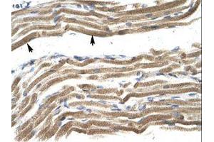 Image no. 1 for anti-Homeobox A10 (HOXA10) (N-Term) antibody (ABIN202418) (HOXA10 antibody  (N-Term))