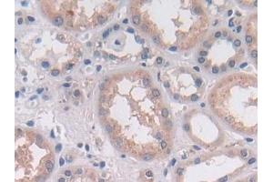 Detection of OAS2 in Human Kidney Tissue using Polyclonal Antibody to 2',5'-Oligoadenylate Synthetase 2 (OAS2) (OAS2 antibody  (AA 11-346))