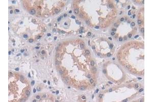 Detection of OAS2 in Human Kidney Tissue using Polyclonal Antibody to 2',5'-Oligoadenylate Synthetase 2 (OAS2)