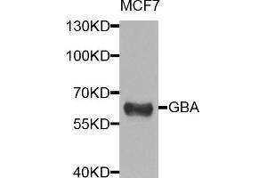 Western blot analysis of extracts of MCF-7 cells, using GBA antibody (ABIN5974589) at 1/1000 dilution. (GBA antibody)
