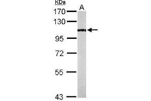 WB Image Sample (50 ug of whole cell lysate) A: Mouse brain 7. (KAT2B antibody  (C-Term))