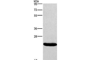 Western Blot analysis of Riji cell using IFNA16 Polyclonal Antibody at dilution of 1:400 (IFNA16 antibody)