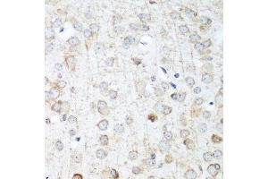 Immunohistochemistry of paraffin-embedded mouse brain using ANKRD52 antibody at dilution of 1:100 (40x lens).