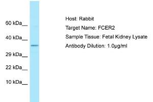 Host: Rabbit Target Name: FCER2 Sample Type: Fetal Kidney lysates Antibody Dilution: 1. (FCER2 antibody  (C-Term))