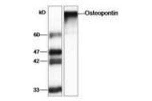 Image no. 1 for anti-Secreted phosphoprotein 1 (SPP1) (AA 17-314) antibody (ABIN791446) (Osteopontin antibody  (AA 17-314))