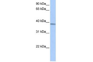 ACADSB antibody used at 1 ug/ml to detect target protein.