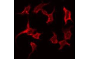 ABIN6268899 staining NIH-3T3 by IF/ICC. (Gastrin antibody  (C-Term))