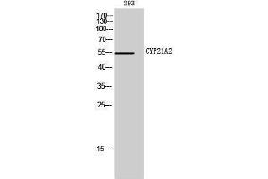 Western Blotting (WB) image for anti-Cytochrome P450, Family 21, Subfamily A, Polypeptide 2 (CYP21A2) (Internal Region) antibody (ABIN3184164) (CYP21A2 antibody  (Internal Region))