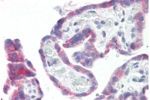Image no. 2 for anti-G Protein-Coupled Receptor 87 (GPR87) (N-Term) antibody (ABIN6749726) (GPR87 antibody  (N-Term))