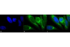 Immunocytochemistry/Immunofluorescence analysis using Mouse Anti-GRP78 Monoclonal Antibody, Clone 1H11-1H7 (ABIN863112). (GRP78 antibody)