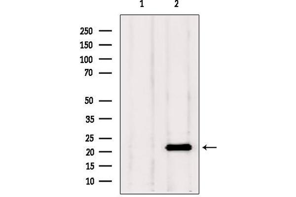 TAGLN2 antibody  (Internal Region)