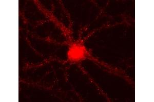 Indirect immunostaining of PFA fixed cultured rat hippocampus neurons (dilution 1 : 500). (Alpha, beta Synuclein antibody)