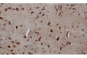 Immunohistochemistry of paraffin-embedded Human brain tissue using PIK3CB Polyclonal Antibody at dilution 1:50 (PIK3CB antibody)