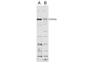 Western Blotting (WB) image for anti-SECIS Binding Protein 2 (SECISBP2) (Internal Region) antibody (ABIN2466241) (SECISBP2 antibody  (Internal Region))