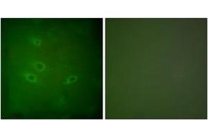Immunofluorescence analysis of HeLa cells, using CARD6 Antibody. (CARD6 antibody  (AA 1-50))