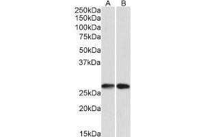 Western Blotting (WB) image for anti-Nicotinamide N-Methyltransferase (NNMT) antibody (ABIN5903827) (NNMT antibody)
