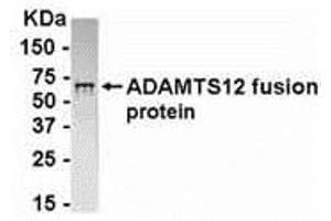 Western Blotting (WB) image for anti-ADAM Metallopeptidase with thrombospondin Type 1 Motif, 12 (ADAMTS12) (AA 297-446) antibody (ABIN2468193) (ADAMTS12 antibody  (AA 297-446))