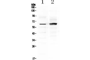 Western blot analysis of Frizzled 4 using anti-Frizzled 4 antibody .