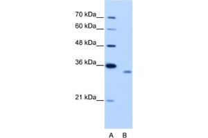 Western Blotting (WB) image for anti-RNA Binding Motif Protein 4B (RBM4B) antibody (ABIN2462313) (RBM4B antibody)