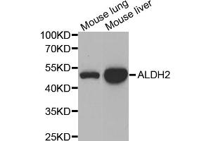 Western blot analysis of extracts of various cell lines, using ALDH2 antibody (ABIN5970568) at 1/1000 dilution. (ALDH2 antibody)