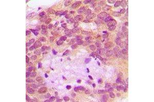 Immunohistochemistry (IHC) image for anti-serine Peptidase Inhibitor, Kunitz Type 1 (SPINT1) antibody (ABIN7308368) (SPINT1 antibody)