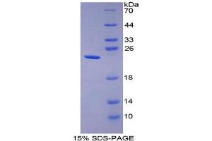 SDS-PAGE analysis of Human Gastrokine 2 Protein.