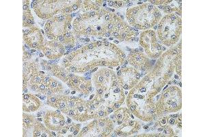 Immunohistochemistry (Paraffin-embedded Sections) (IHC (p)) image for anti-Interferon, gamma-Inducible Protein 16 (IFI16) antibody (ABIN7257561)