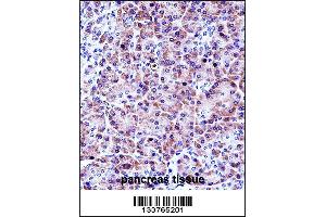 CELA3A Antibody immunohistochemistry analysis in formalin fixed and paraffin embedded human pancreas tissue followed by peroxidase conjugation of the secondary antibody and DAB staining. (Elastase 3A antibody  (AA 157-186))