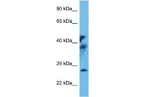 Host:  Rabbit  Target Name:  RAX  Sample Tissue:  Human 293T Whole Cell  Antibody Dilution:  1ug/ml